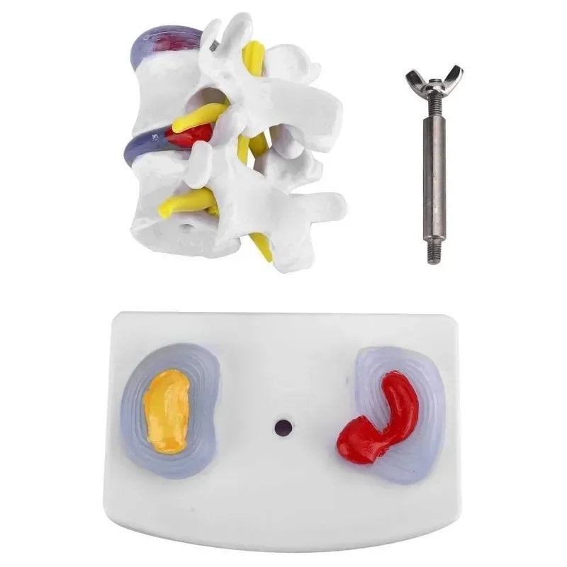 1:1 Life size Anatomical Human Lumbar Disc Herniation Demonstration Spine Anatomy Model School Training Supplies