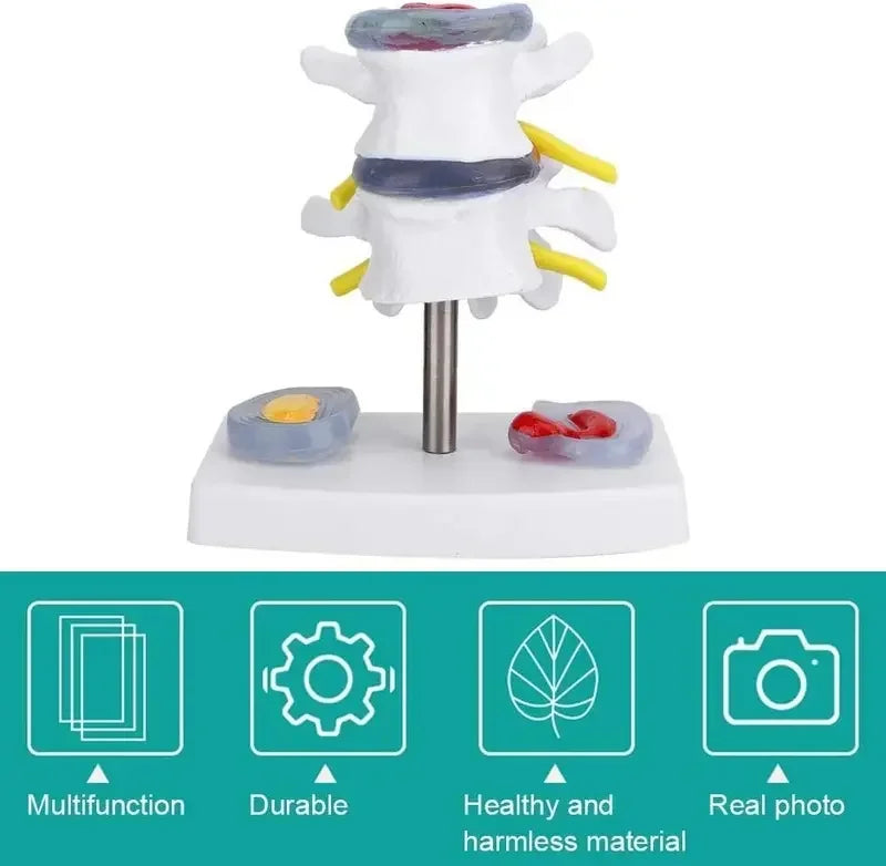 1:1 Life size Anatomical Human Lumbar Disc Herniation Demonstration Spine Anatomy Model School Training Supplies