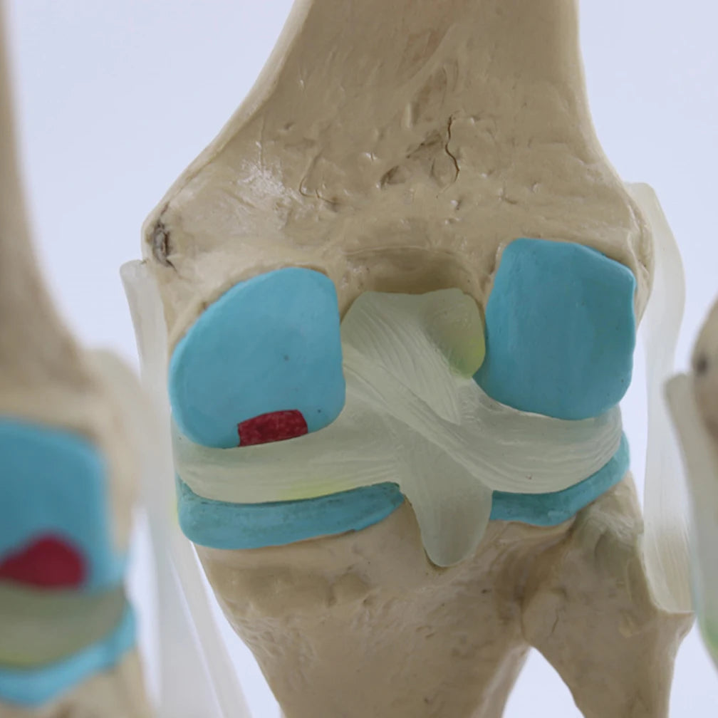 Anatomical Human Degenerative 4-stage Knee Joint Disease Model PVC Bone Medical Skeleton Anatomy Teaching Resources ﻿Wholesale